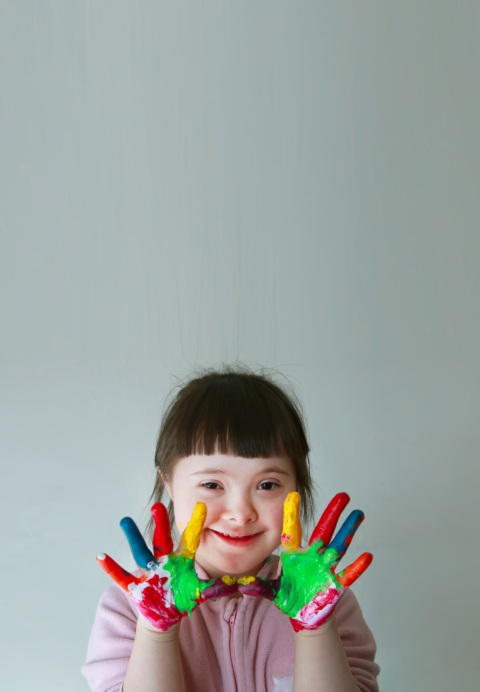 down-syndrome_273198575